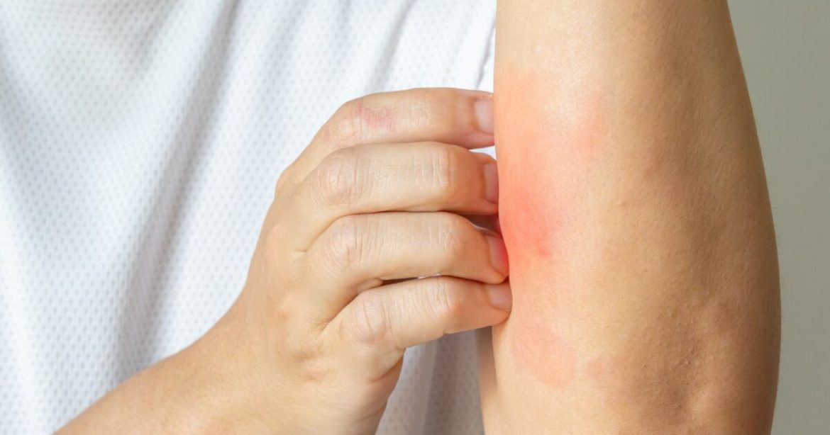 A Promising New Treatment for Millions of Americans Suffering from Skin Conditions