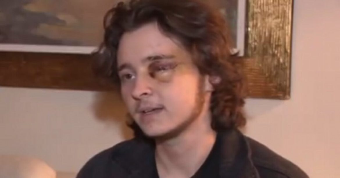 FAFO: ICE Protester in California Loses an Eye After Rushing Agents and Getting Shot With Projectile (VIDEO)