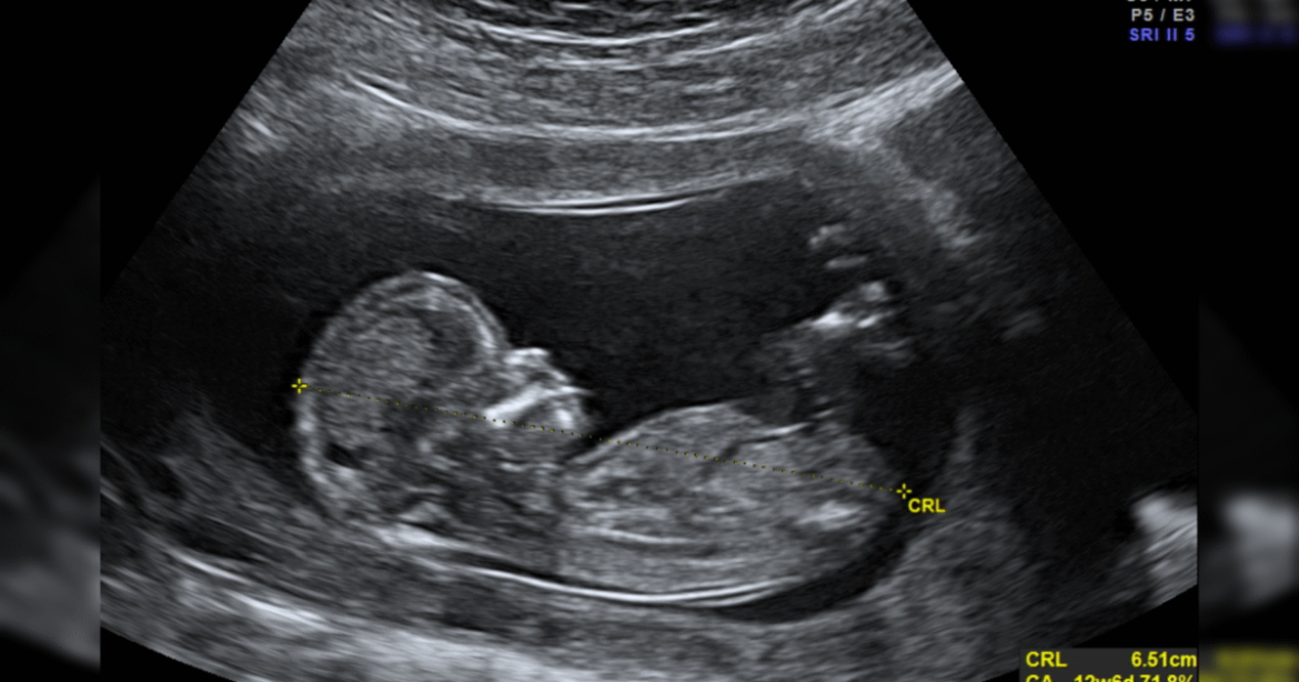 Abortion Providers Don’t Deserve Our Appreciation