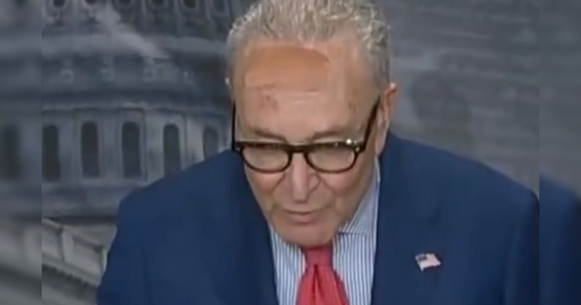 Senator Chuck Schumer Attends Press Conference With Giant Bandage on Forehead — Claims He Ran Into Door