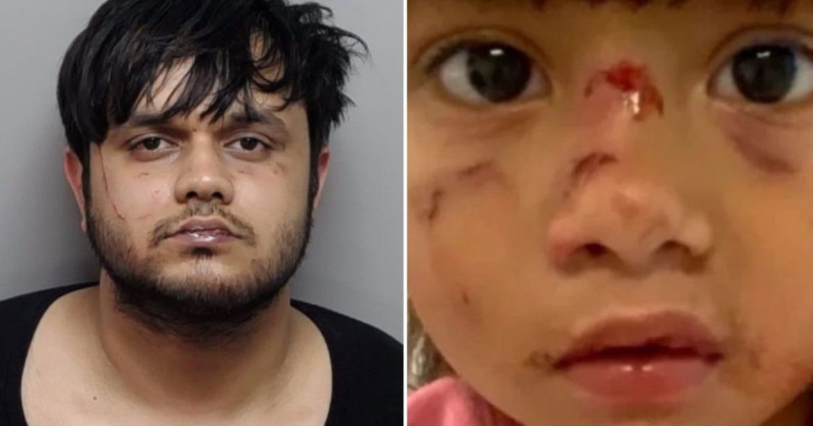 ‘Like a Scene Out of a Horror Movie’: Illegal Alien Arrested After Punching Mother in the Face and Savagely Biting and Trying to Eat Her Three-Year-Old Daughter’s Face in Unprovoked Texas Park Attack