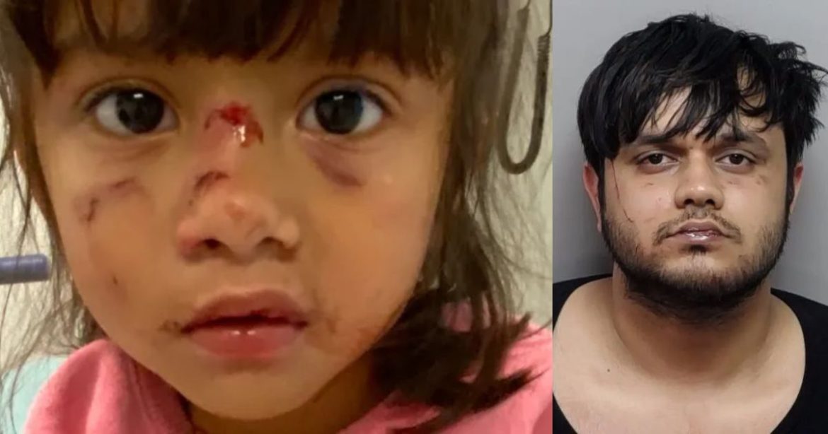 Biden Admin Let Illegal Alien Cannibal Stay in U.S. After Previous Felony Assault Deemed ‘Not Egregious Enough,’ Now He Tried to Eat Three-Year-Old Girl’s Face in Texas Park