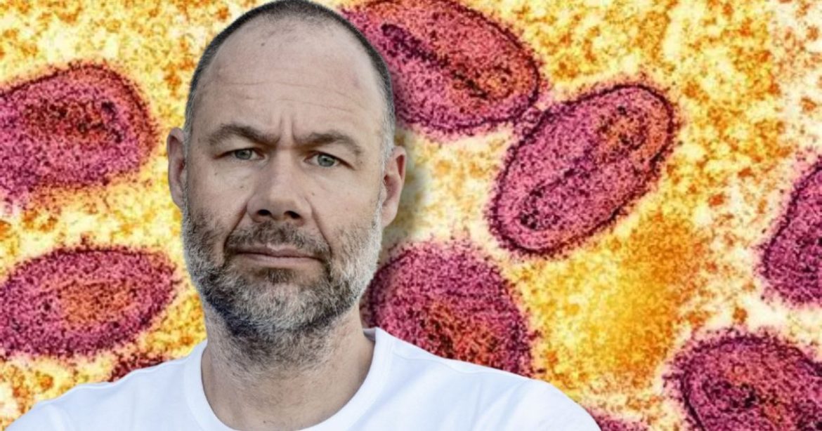 Fauci’s Foreign National Bat Virus Mad Scientist Vincent Munster and His Researcher Charged with Smuggling Monkeypox into America from African Outbreak